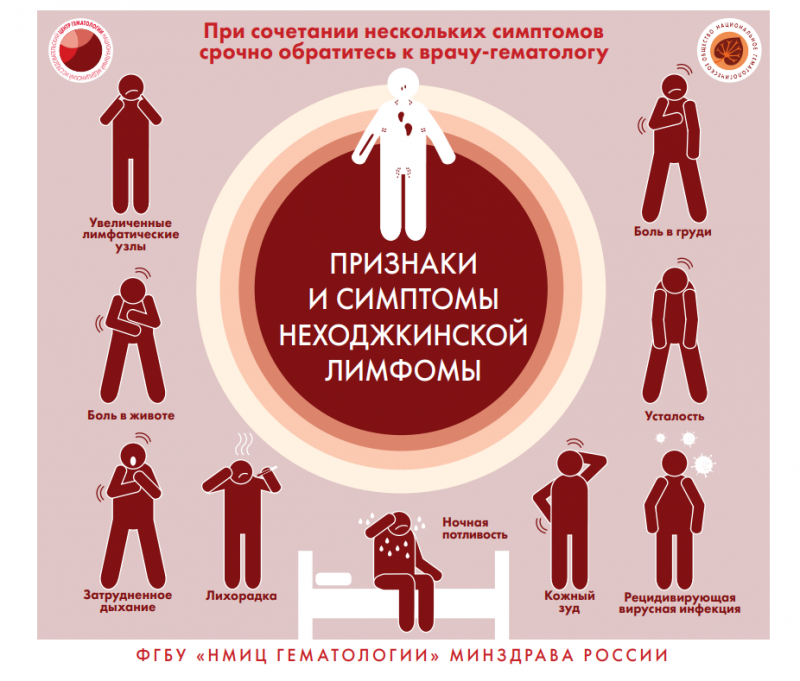 Признаки и симптомы неходжкинской лимфомы