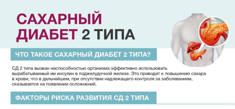О сахарном диабете 2 типа