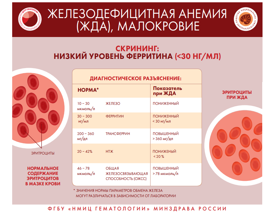 Признаки и симптомы неходжкинской лимфомы