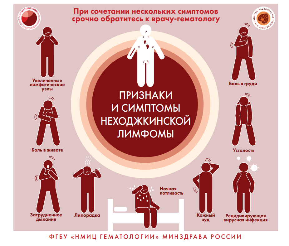 Признаки и симптомы неходжкинской лимфомы