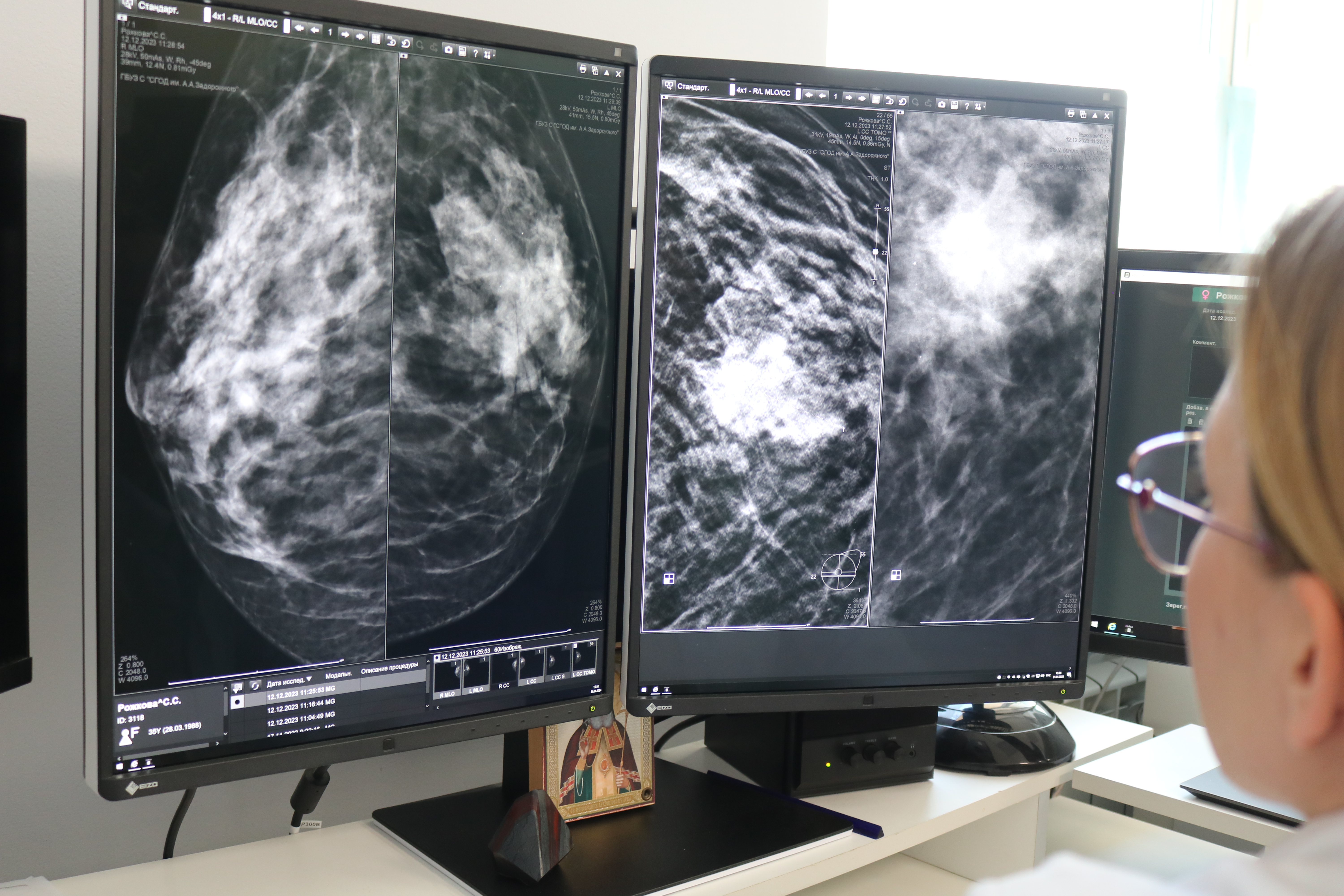 В Севастопольском онкологическом диспансере подвели итоги акции «Неделя раннего выявления онкологических заболеваний»