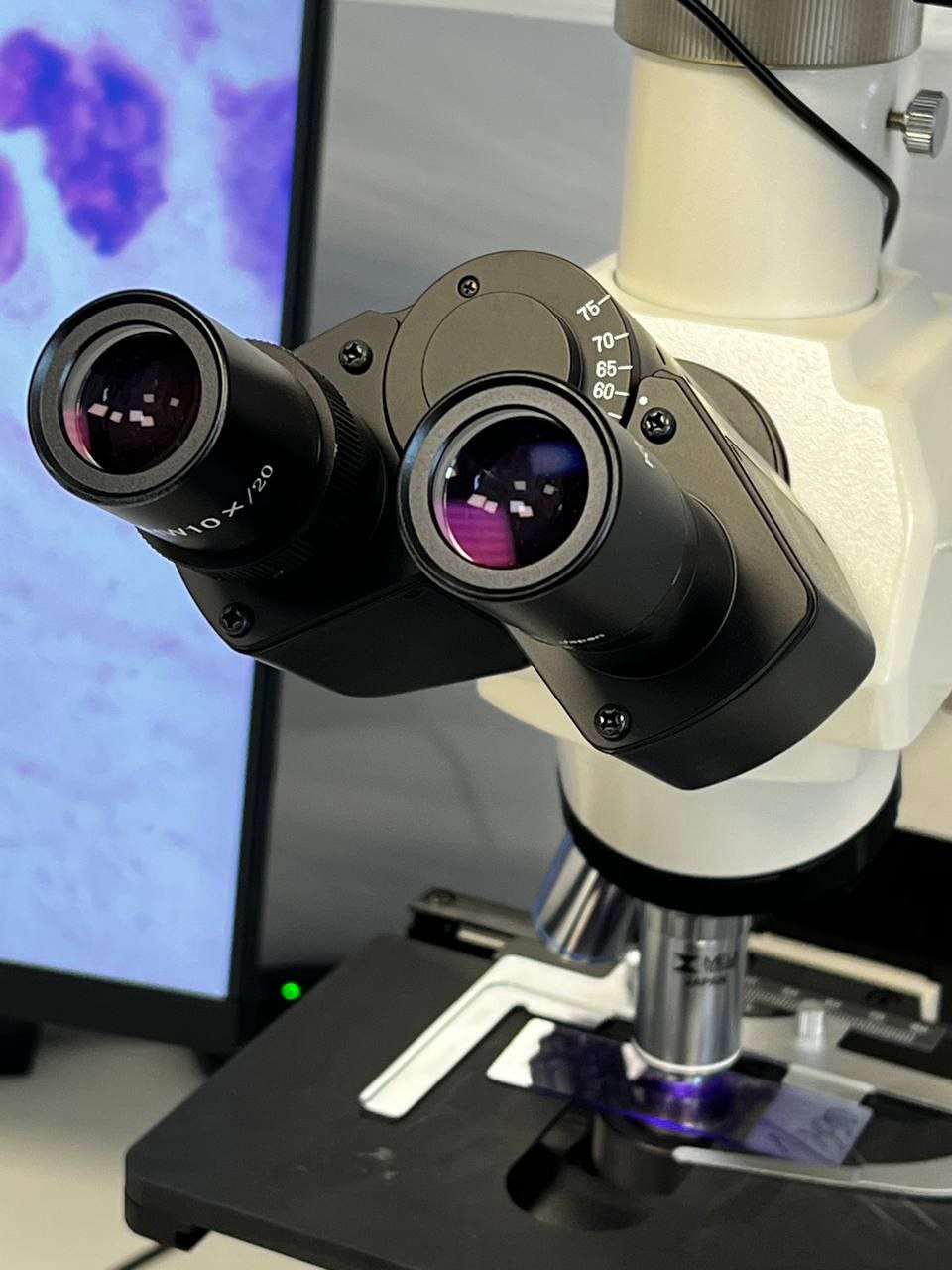 Севастопольский противотуберкулёзный диспансер успешно прошел федеральную проверку качества лабораторных исследований