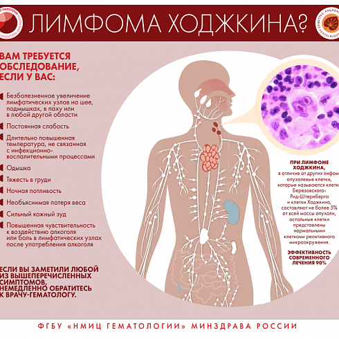 Признаки и симптомы неходжкинской лимфомы