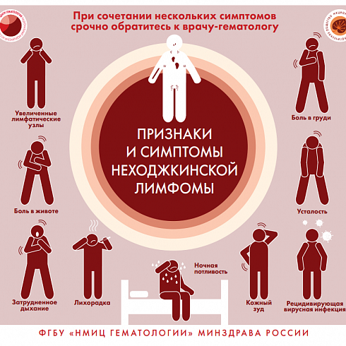 Признаки и симптомы неходжкинской лимфомы