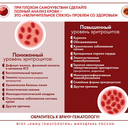 Признаки и симптомы неходжкинской лимфомы
